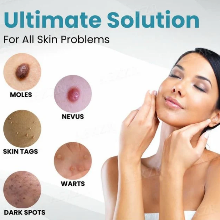 Cleura Mole and Wart Removal Pen